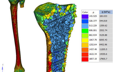 Comparative analysis of tibial plateau fracture osteosynthesis: A finite element study