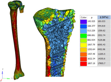 Comparative analysis of tibial plateau fracture osteosynthesis: A finite element study