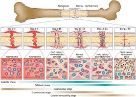 Physical and biological aspects of fracture healing with special reference to internal fixation